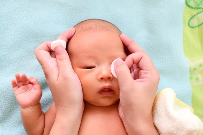 Cara Menghilangkan Belek pada Bayi: Panduan Lengkap untuk Orangtua