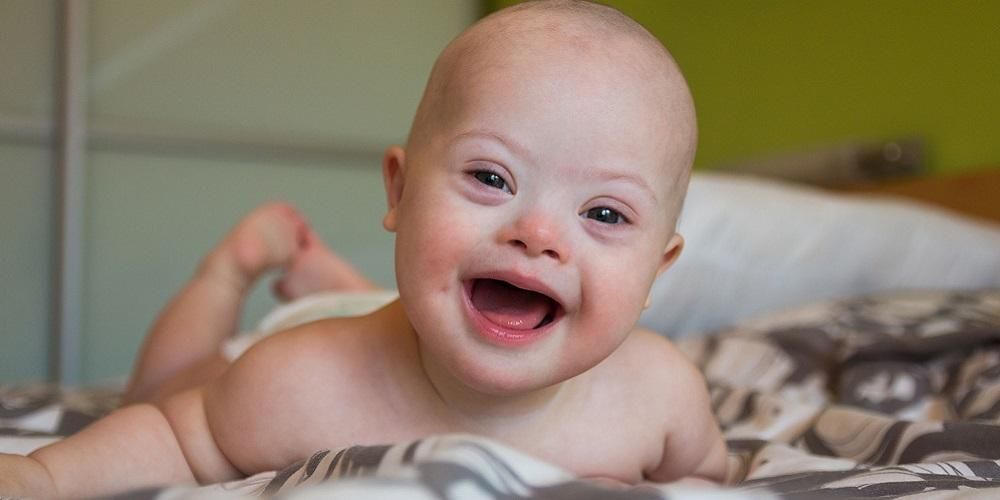 Mengenal Lebih Dekat Ciri-ciri Bayi dengan Sindrom Down
